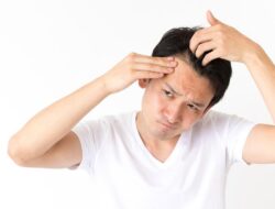 Lebat Tanpa Dibotak, Dokter Jelaskan Transplantasi Rambut Tanpa Cukur